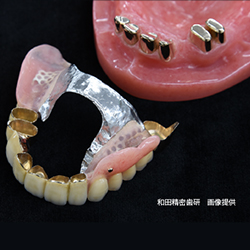 金属のフレームと強化プラスチック
